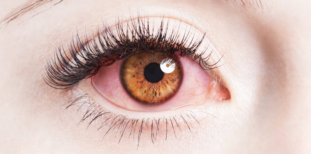 vörös szemek ellen száraz szem kezelés